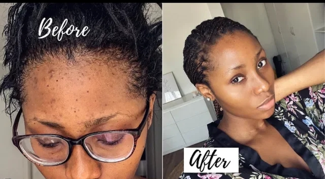 Famous YouTuber, Dimma Umeh shares her skincare routine